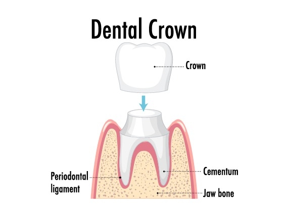 Prosthodontics