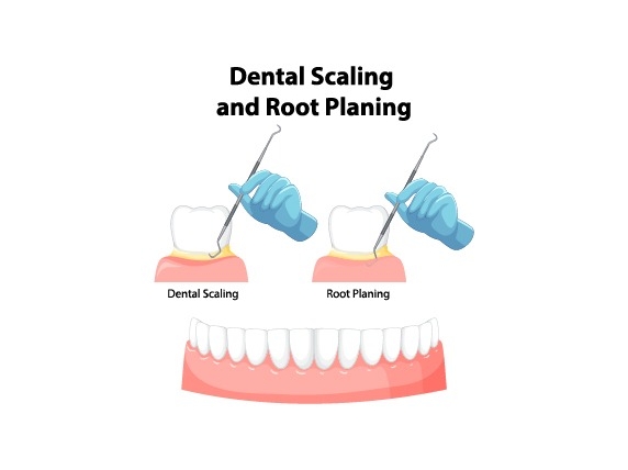 Periodontics