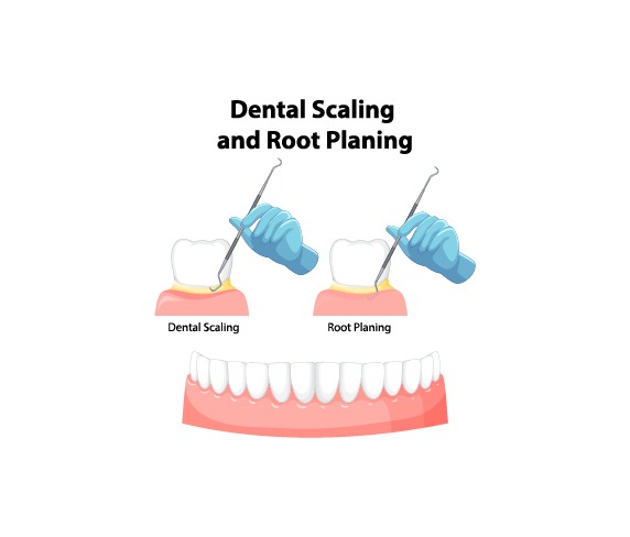 Periodontics